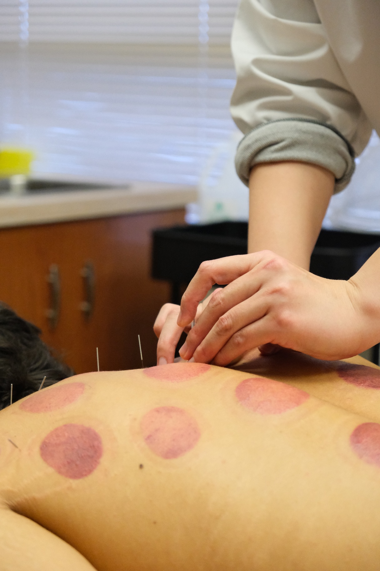 Social-First Rehab & Wellness Storytelling for Sumu Rehab Clinic